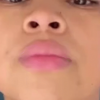 TONIFICADOR FACIAL ANTIARRUGAS