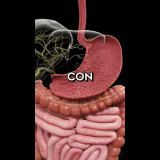 GOMITAS VINAGRE DE MANZANA MANZANA VERDE